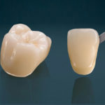 Tooth crown Tooth crown