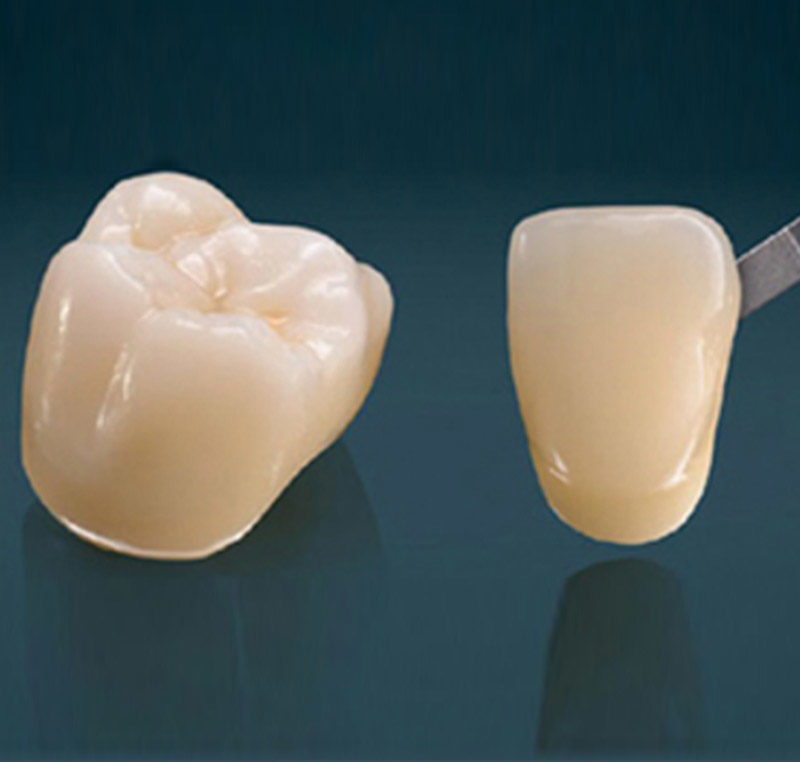 Tooth crown