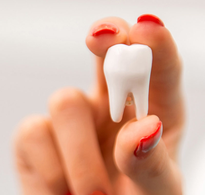 Wisdom-Teeth-Extraction-page