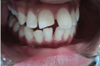 case 1 before