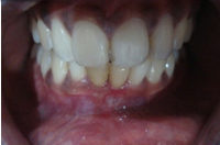 case 2 before
