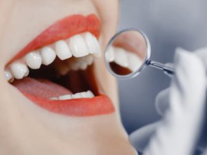 Dental Bonding