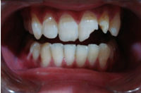 third1